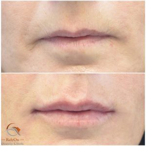 Bästa estetisk behandlare i Örebro