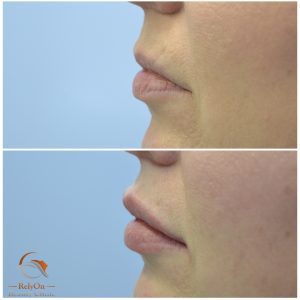 Bästa injektionsbehandlare i Örebro