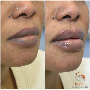 Russian Lips Örebro