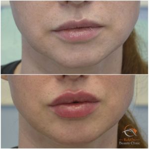 Russian Lips Örebro